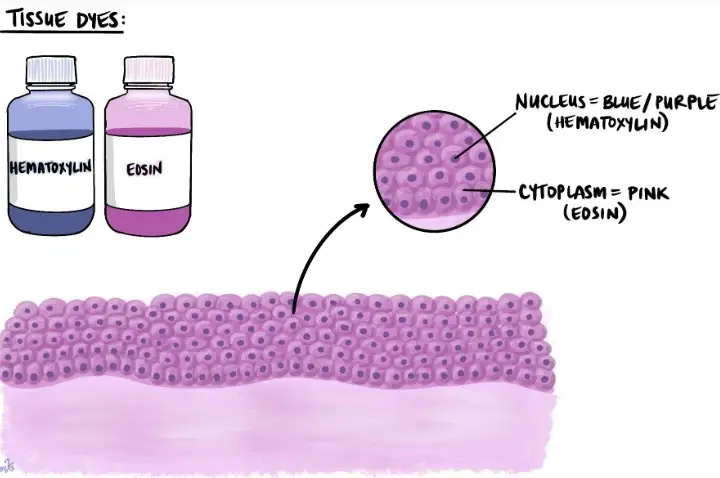 ImageJ实用教程——HE染色炎症浸润面积统计(案例分析篇)
